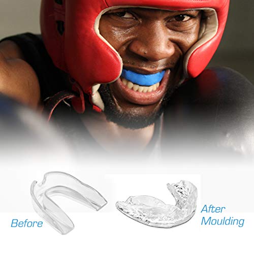 Slim Fitness SET OF 5 Professional Dental Guard Teeth Grinding Gum Shield Mouth guard Boxing judo MMA Thai boxing Basketball Ice hockey and for all other sports available in five colours (Black)