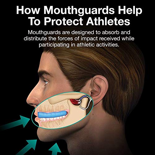 HyperShields Pro Mouth Guard - Gum Shield - Mouth Guards - for boxing, MMA, rugby, hockey, judo, martial arts and all contact sports -With Case Custom Fit Moldable Sports MouthGuards (Blue Youth)